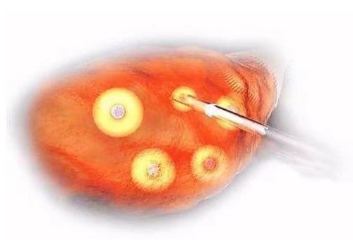 重庆助孕机构：产后身体虚弱可以吃榴莲，但一定要控制量