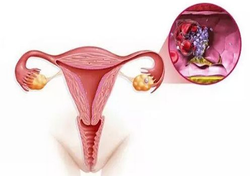 重庆三代试管助孕：在怀孕期间，女性做什么让生双胞胎的几率最大？